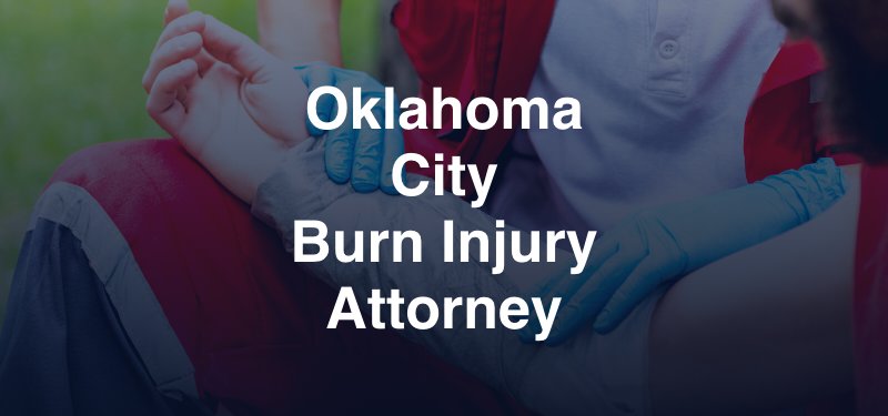 Oklahoma City Burn Injury Attorney